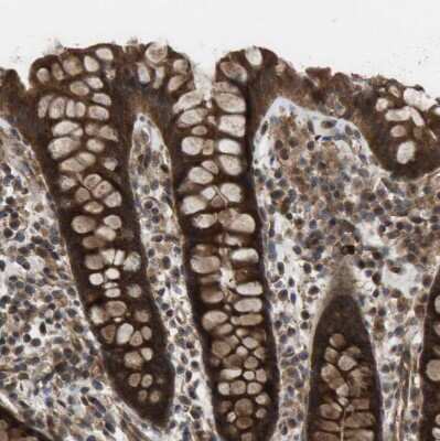 Immunohistochemistry-Paraffin: CTPS2 Antibody [NBP1-86055]
