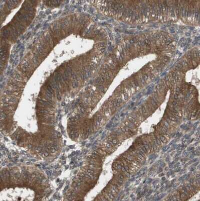 Immunohistochemistry-Paraffin: CTPS2 Antibody [NBP1-86055]
