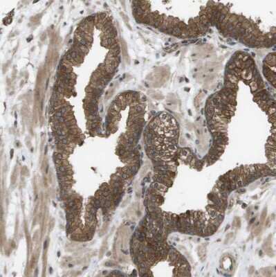 Immunohistochemistry-Paraffin: CTPS2 Antibody [NBP1-86055]