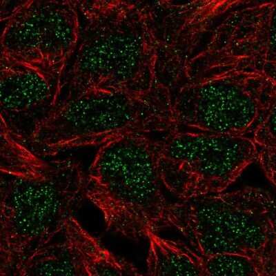 Immunocytochemistry/ Immunofluorescence: CTR9 Antibody [NBP2-49547]