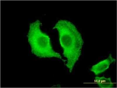 Immunocytochemistry/ Immunofluorescence: CTRB1 Antibody (3C8) [H00001504-M02]