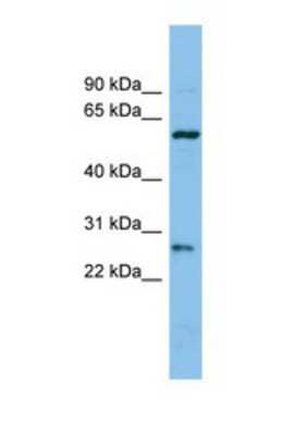 Western Blot: CTRB1 Antibody [NBP1-69669]