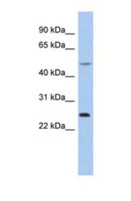 Western Blot: CTRB1 Antibody [NBP1-69699]