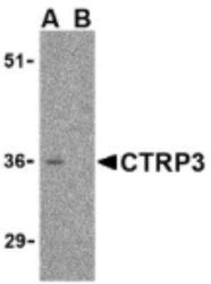 Western Blot: C1qTNF3/CORS26/CTRP3 Antibody Blocking Peptide [NBP1-76628PEP]