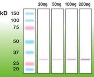 Western Blot: C1qTNF5/CTRP5 Antibody (A14-A) [NBP1-30131]