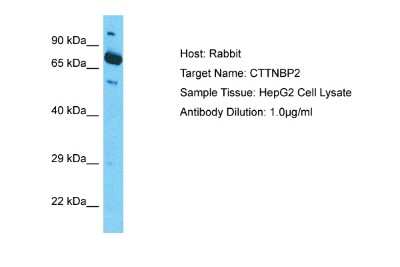 Western Blot: CTTNBP2 Antibody [NBP2-82778]