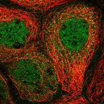 Immunocytochemistry/ Immunofluorescence: CUEDC2 Antibody [NBP1-88538]