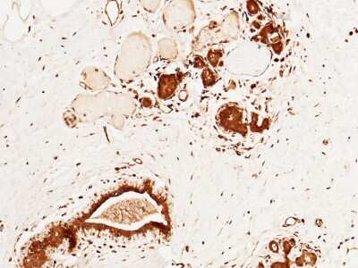 Immunohistochemistry-Paraffin: CUEDC2 Antibody [NBP2-99801]