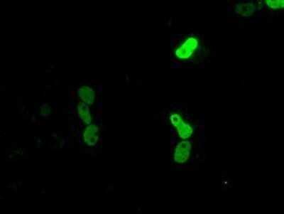 Immunocytochemistry/ Immunofluorescence: CUGBP1/CELF1 Antibody (OTI5B8) - Azide and BSA Free [NBP2-71623]