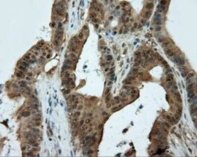 Immunohistochemistry: CUGBP1/CELF1 Antibody (OTI5B8) - Azide and BSA Free [NBP2-71623]