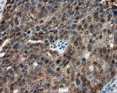 Immunohistochemistry: CUGBP1/CELF1 Antibody (OTI5B8) - Azide and BSA Free [NBP2-71623]