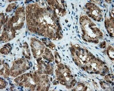 Immunohistochemistry: CUGBP1/CELF1 Antibody (OTI5B8) - Azide and BSA Free [NBP2-71623]