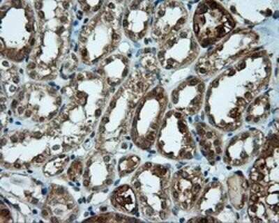 Immunohistochemistry-Paraffin: CUGBP1/CELF1 Antibody (OTI5B8) [NBP2-02343]
