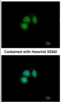 Immunocytochemistry/ Immunofluorescence: CUGBP2 Antibody [NBP2-16035]