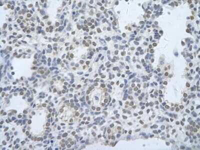Immunohistochemistry: CUGBP2 Antibody [NBP1-57376]