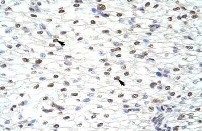 Immunohistochemistry: CUGBP2 Antibody [NBP1-57376]