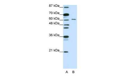 Western Blot: CUGBP2 Antibody [NBP1-57376]