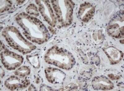 Immunohistochemistry: CUL4B Antibody (OTI1C4) [NBP2-45648]