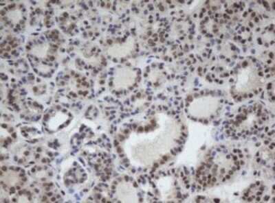 Immunohistochemistry: CUL4B Antibody (OTI1C4) [NBP2-45648]