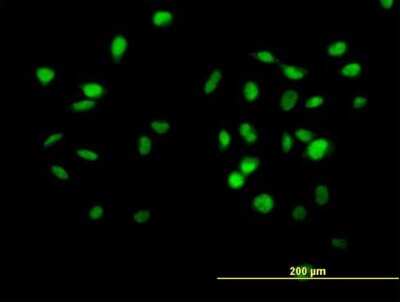 Immunocytochemistry/ Immunofluorescence: CUL4B Antibody [H00008450-B01P]