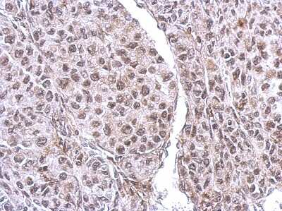 Immunohistochemistry-Paraffin: CUTC Antibody [NBP2-16038]