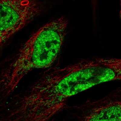 Immunocytochemistry/ Immunofluorescence: CWC15 Antibody [NBP2-31977]
