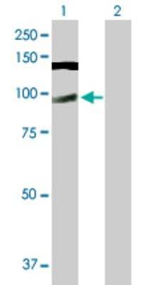 Western Blot: CWC22 Antibody [H00057703-B01P]