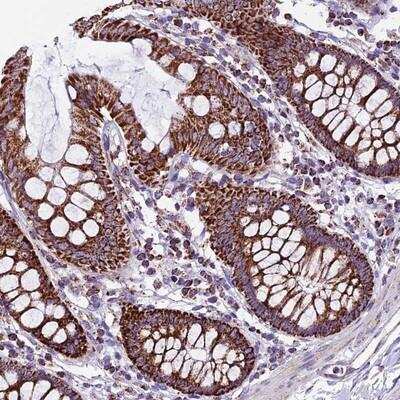 Immunohistochemistry-Paraffin: CX3CL1/Fractalkine Antibody [NBP1-89309]