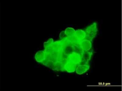 Immunocytochemistry/ Immunofluorescence: CX3CR1 Antibody [H00001524-B01P]