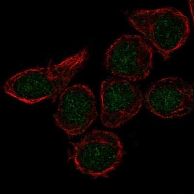 Immunocytochemistry/ Immunofluorescence: CX3CR1 Antibody [NBP2-69050]