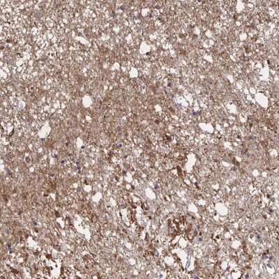 Immunohistochemistry-Paraffin: CX3CR1 Antibody [NBP2-38554]