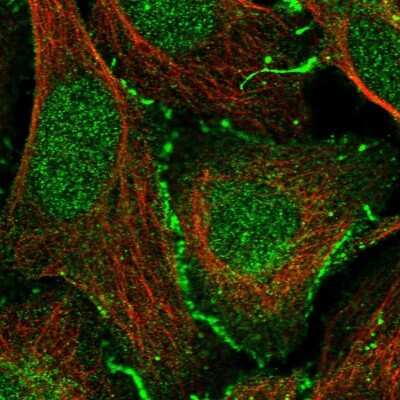 Immunocytochemistry/ Immunofluorescence: CXADR Antibody [NBP1-88192]