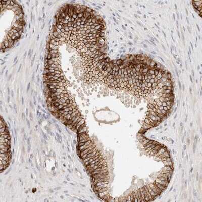 Immunohistochemistry-Paraffin: CXADR Antibody [NBP1-88192]