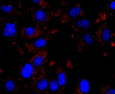 Immunocytochemistry/ Immunofluorescence: CXCL10/IP-10/CRG-2 Antibody (JA10-82) [NBP2-67004]
