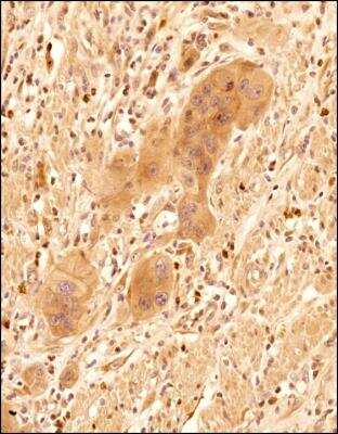 Immunohistochemistry-Paraffin: CXCL13/BLC/BCA-1 Antibody - BSA Free [NBP2-16041]