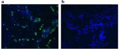 Immunocytochemistry/ Immunofluorescence: CXCL16 Antibody (4.4) - BSA Free [NBP2-50187]