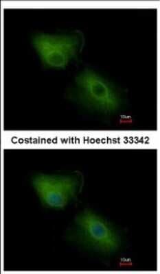 Immunocytochemistry/ Immunofluorescence: CXCL16 Antibody [NBP2-16042]
