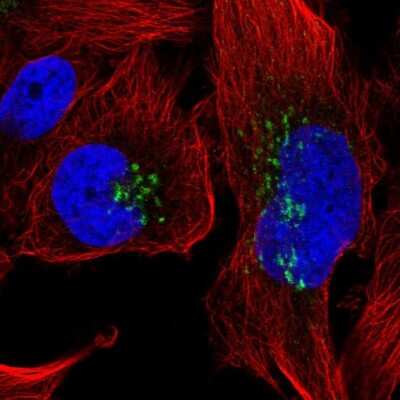 Immunocytochemistry/ Immunofluorescence: CXCL8/IL-8 Antibody [NBP2-33819]
