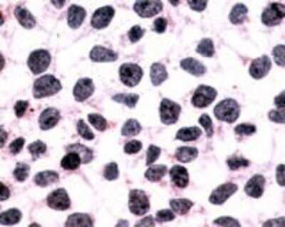 Immunohistochemistry-Paraffin: CXCR1/IL-8RA Antibody - BSA Free [NLS806]