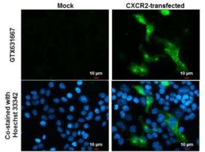 Immunocytochemistry/ Immunofluorescence: CXCR2/IL-8RB Antibody (547) [NBP2-43810]