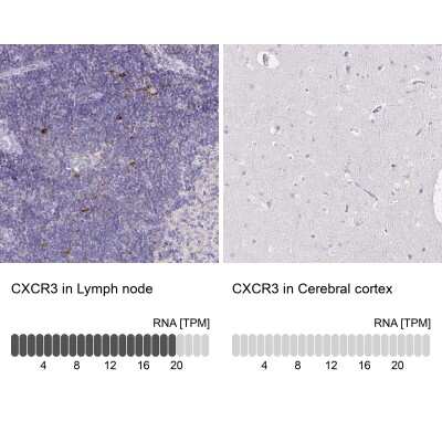Immunohistochemistry-Paraffin: CXCR3 Antibody [NBP2-38547]