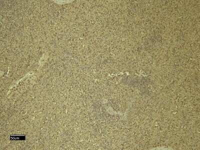 Immunohistochemistry-Paraffin: CXCR3 Antibody [NBP2-77442]