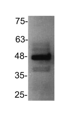 Western Blot: CXCR3 Antibody [NB100-56404]