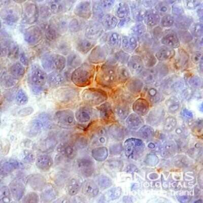 Immunohistochemistry: CXCR4 Antibody - Azide Free [NBP2-24862]