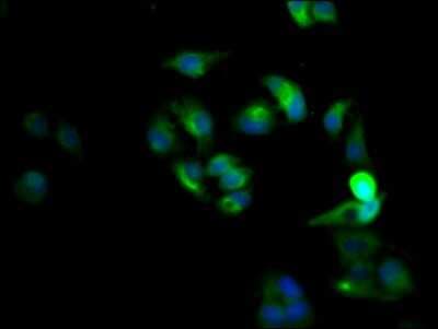 Immunocytochemistry/ Immunofluorescence: CXCR4 Antibody (2F10) [NBP3-15137]