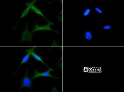 Immunocytochemistry/ Immunofluorescence: CXCR4 Antibody [NB100-74396]