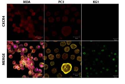 Immunocytochemistry/ Immunofluorescence: CXCR4 Antibody [NB100-74396]