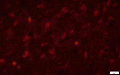 Immunohistochemistry-Frozen: CXCR4 Antibody - BSA Free [NLS1380]