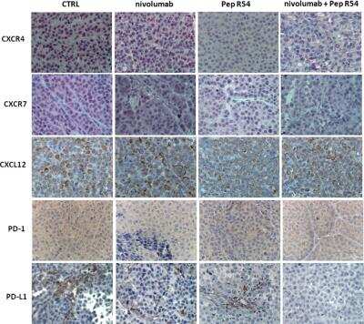 Immunohistochemistry: CXCR4 Antibody [NB100-74396]