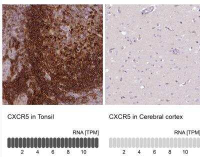 Immunohistochemistry-Paraffin: CXCR5 Antibody [NBP2-48763]